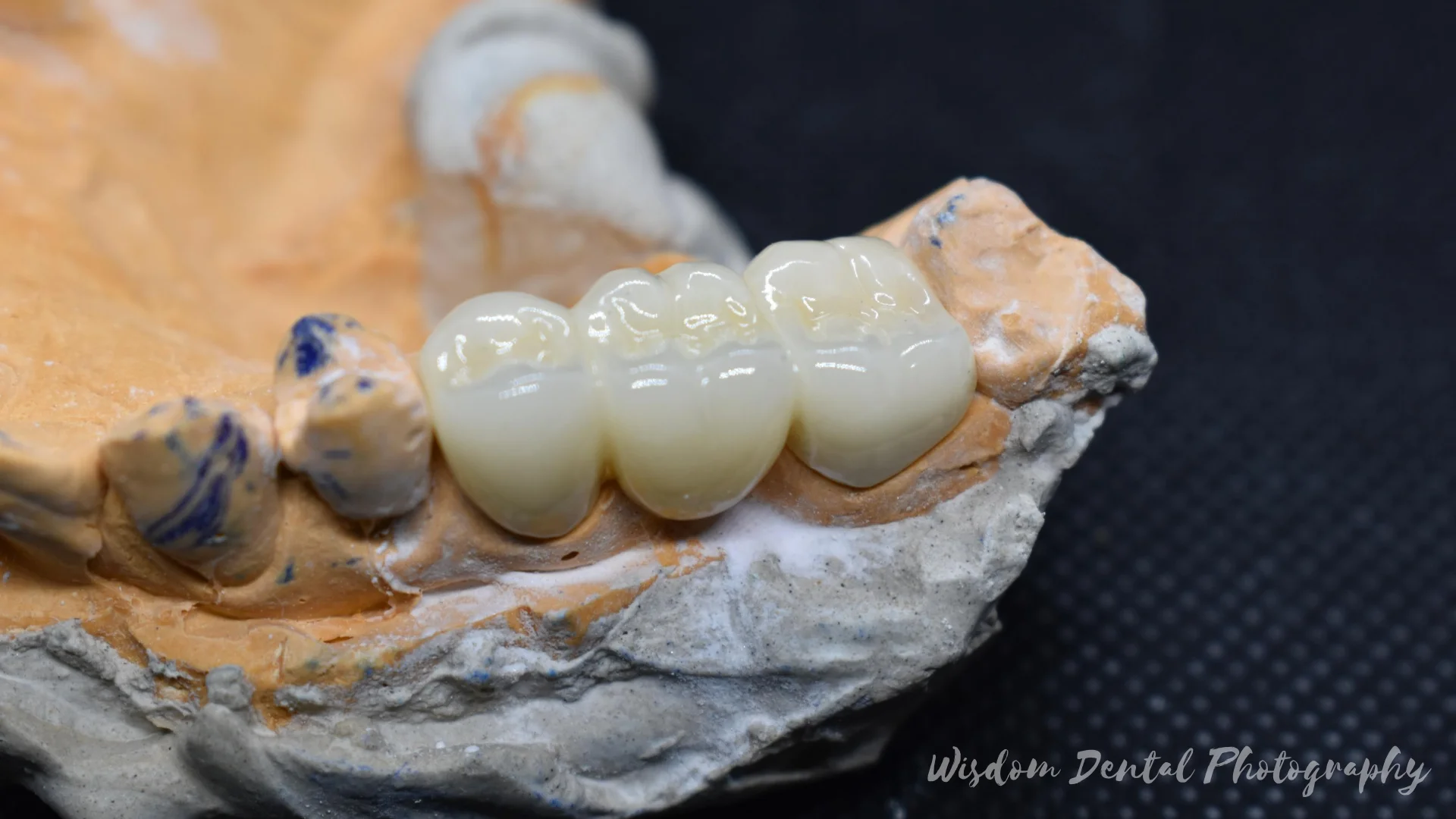 Wisdom Dental