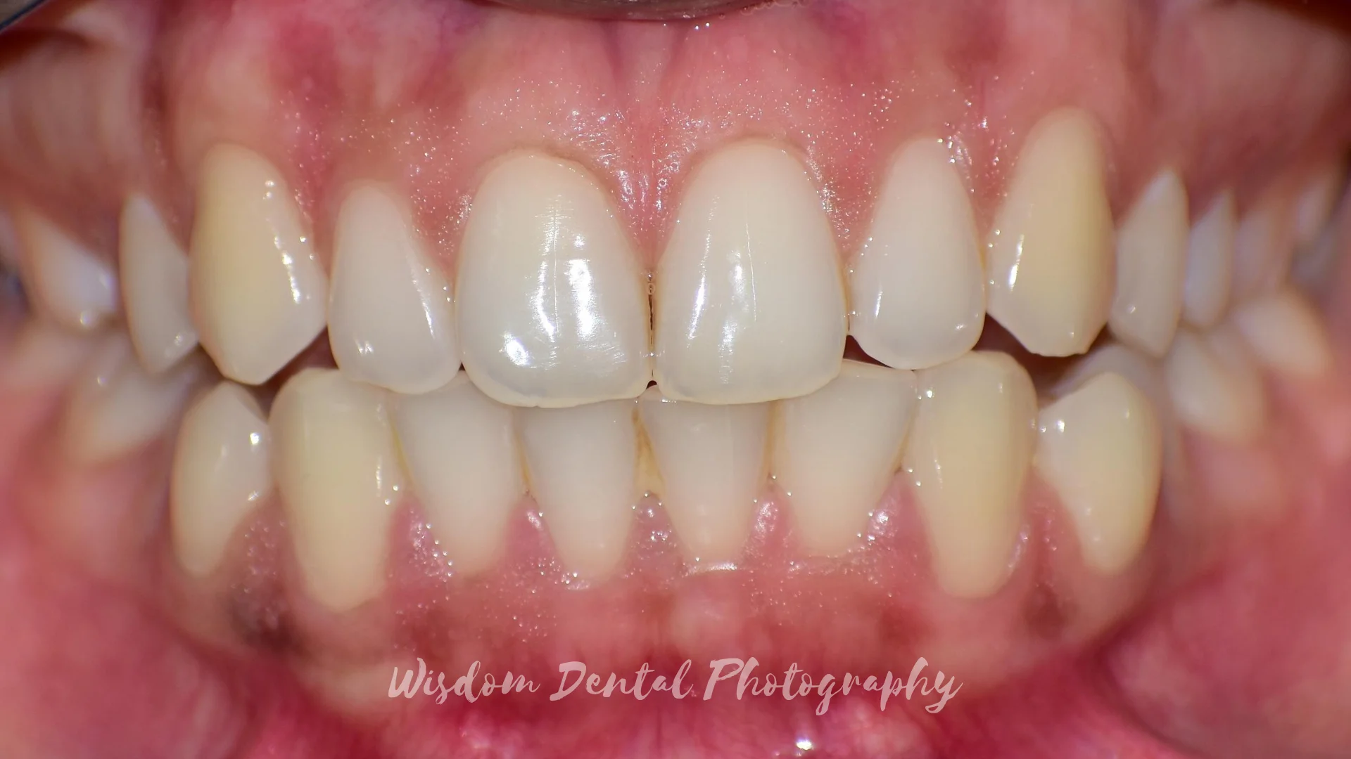 Wisdom Dental