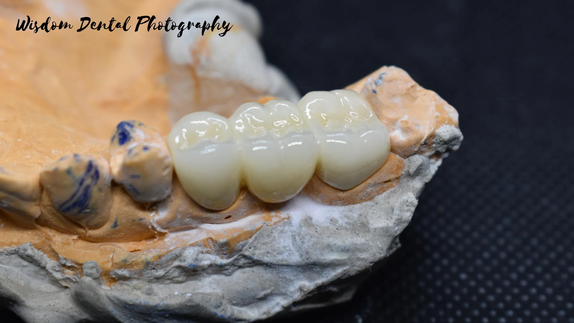 Wisdom Dental