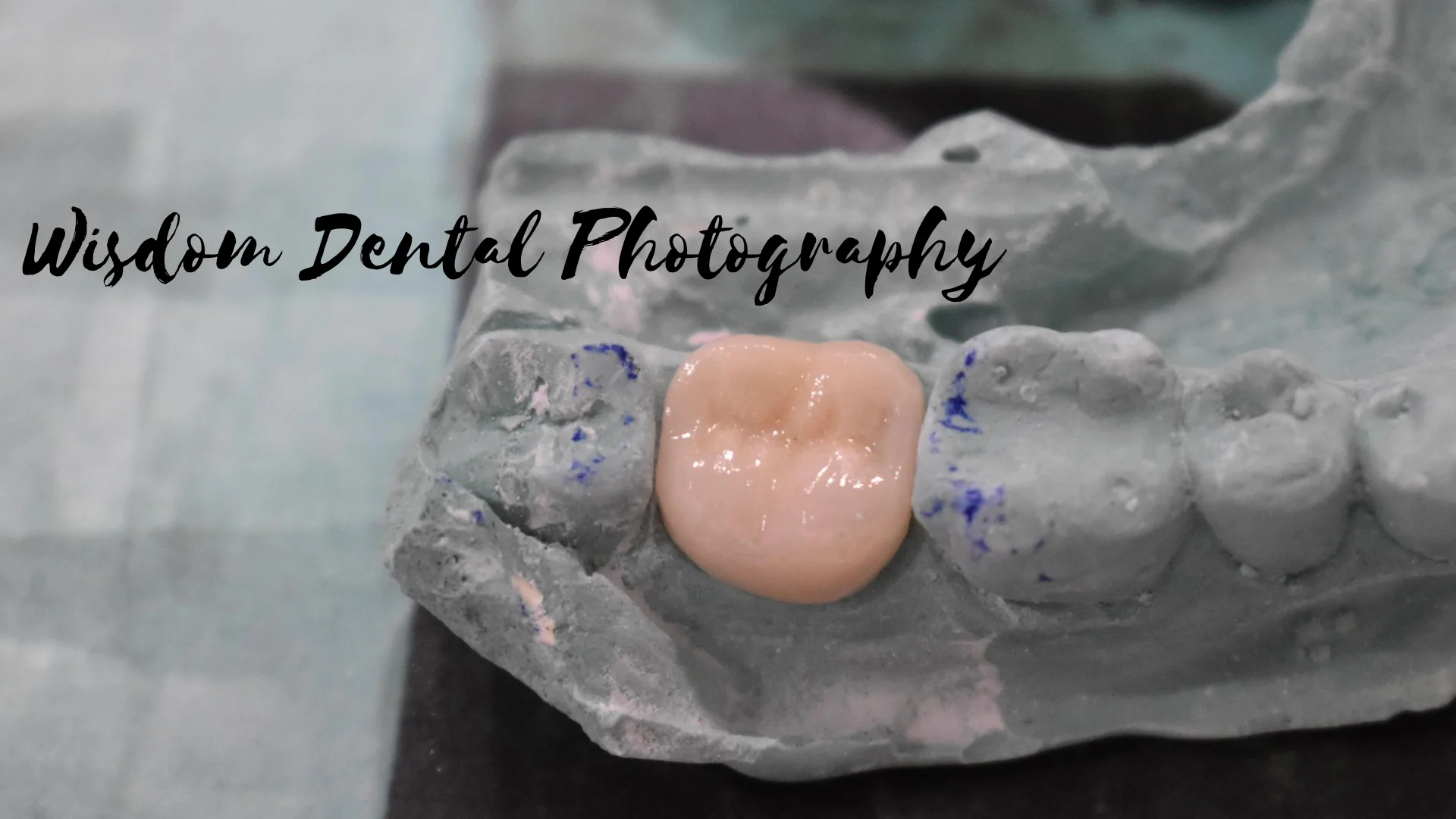 Wisdom Dental