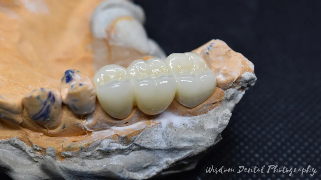 Wisdom Dental