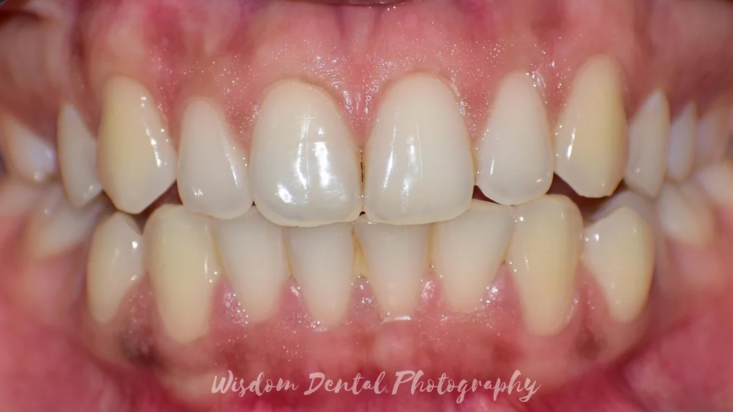 Wisdom Dental