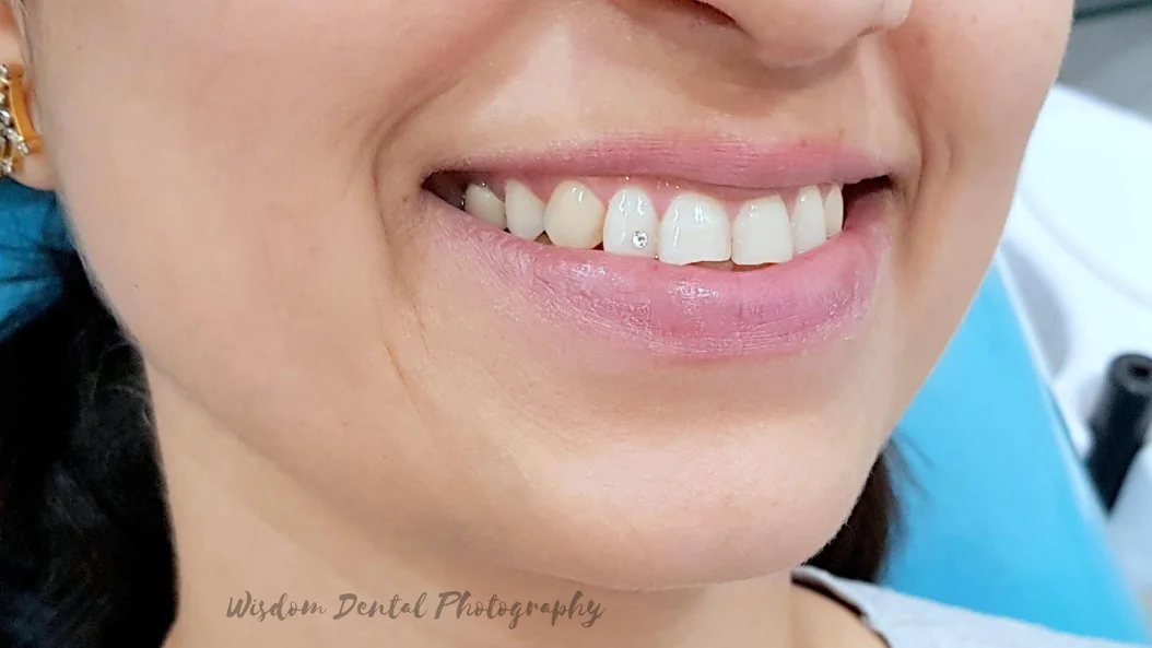 Wisdom Dental