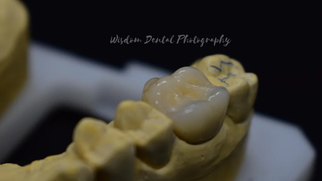Wisdom Dental