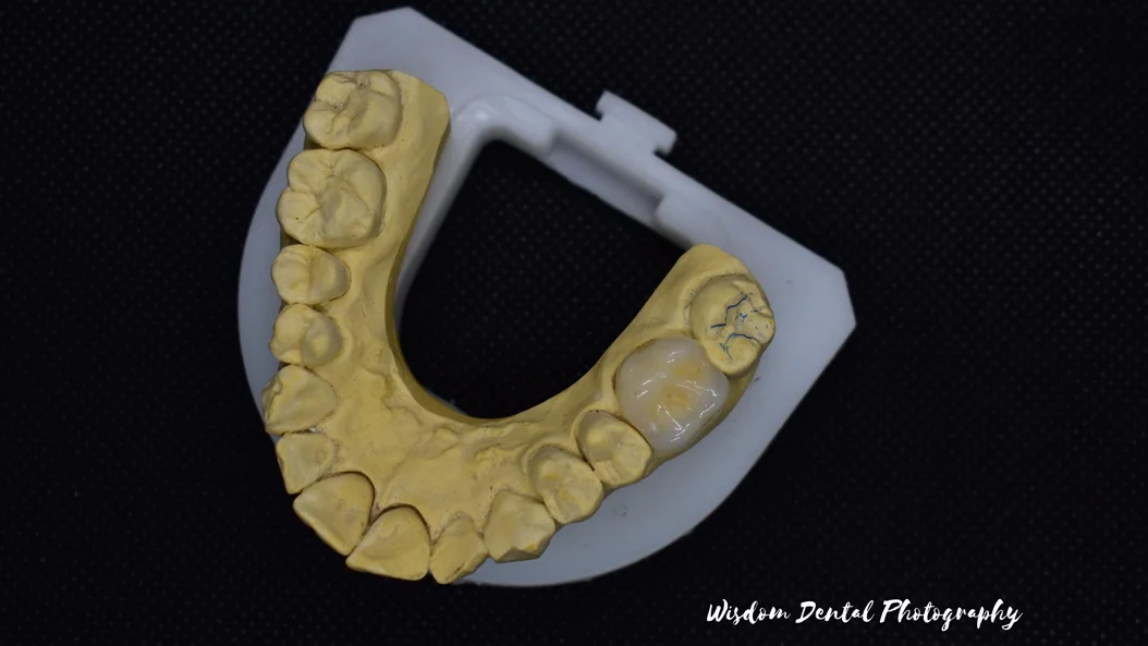 Wisdom Dental