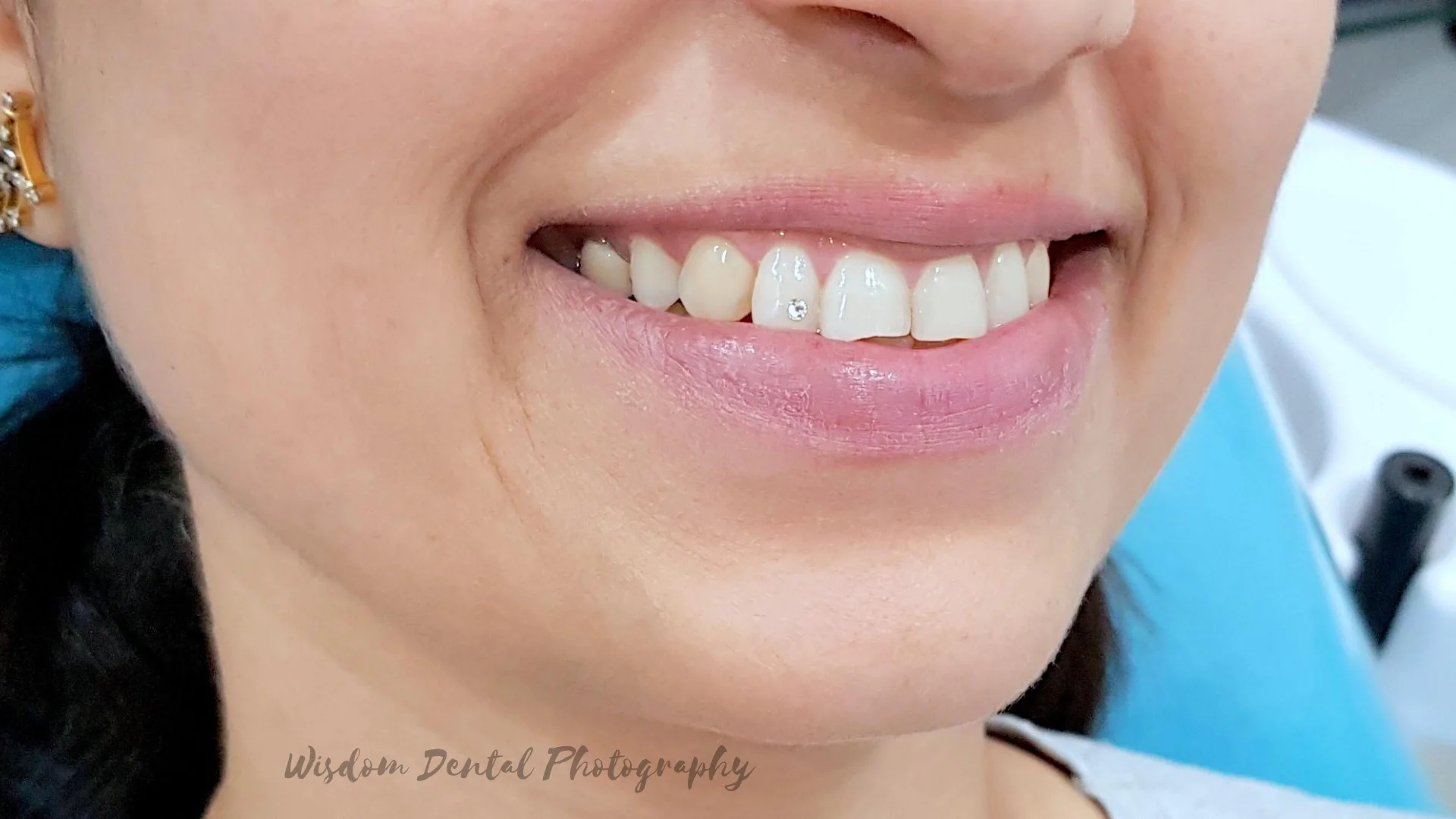 Wisdom Dental