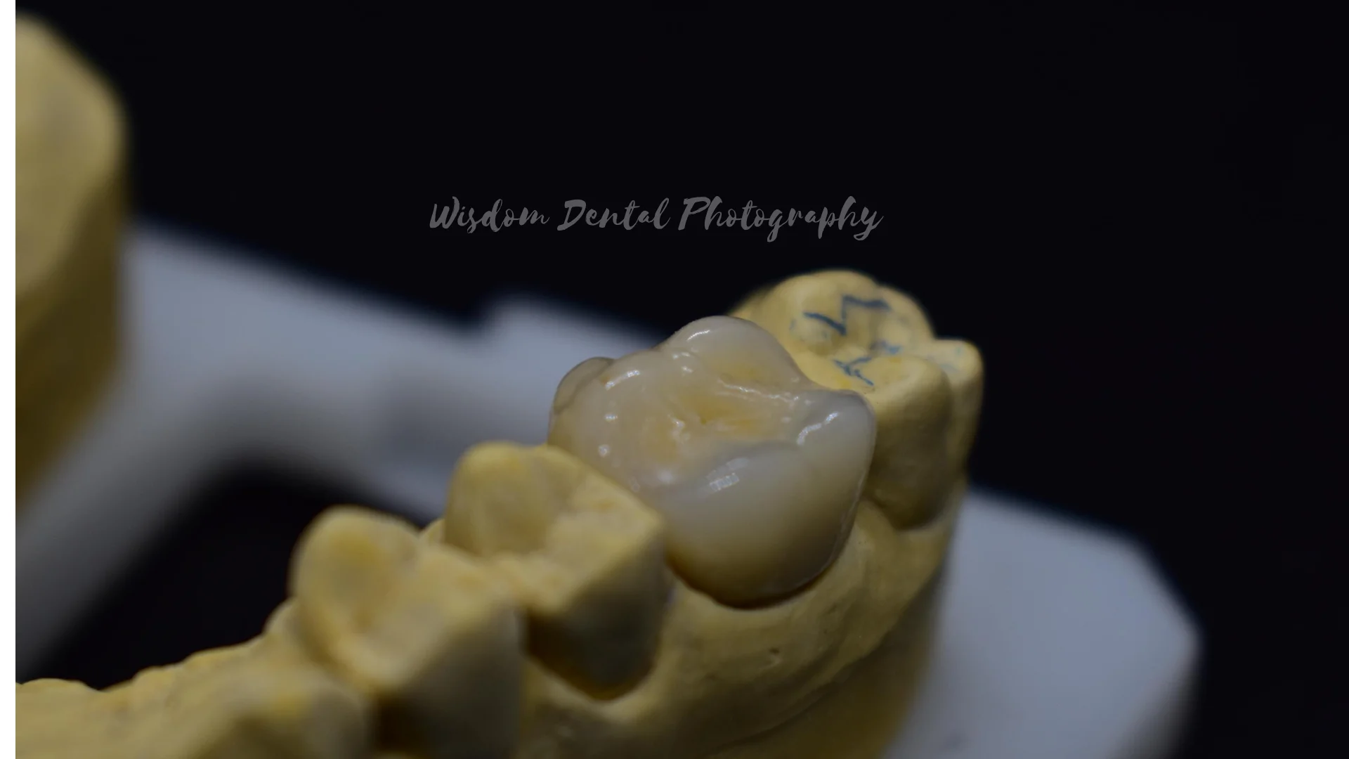 Wisdom Dental