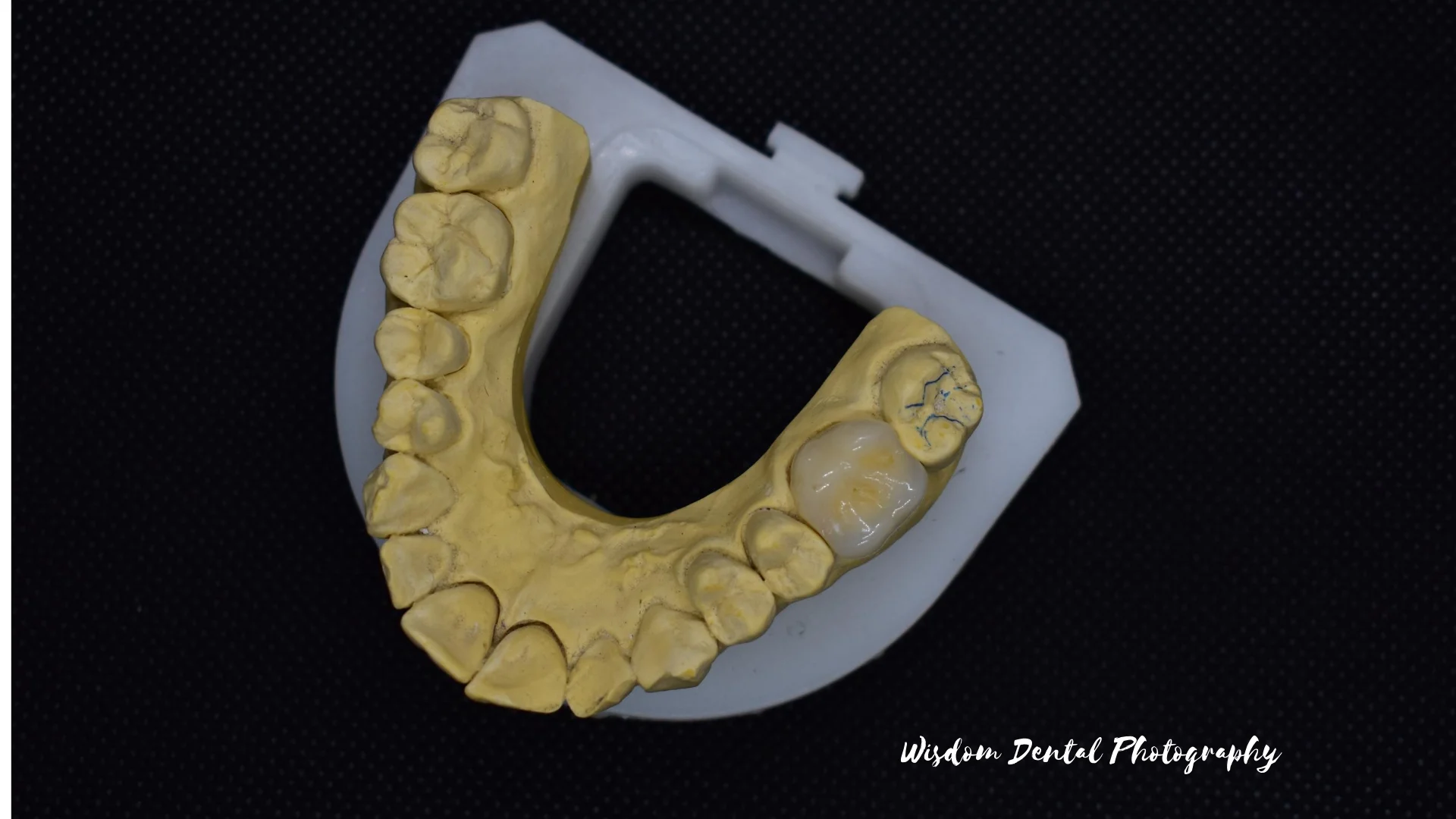 Wisdom Dental