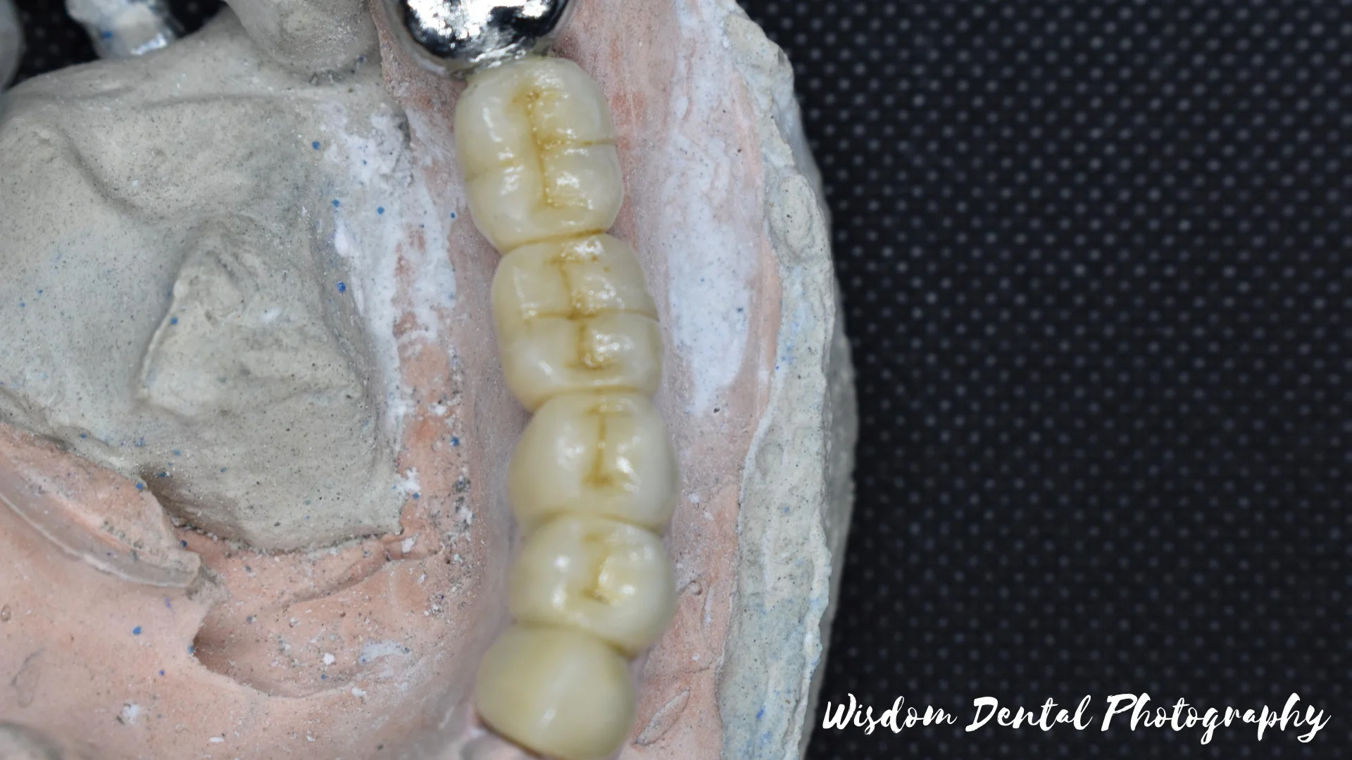 Wisdom Dental