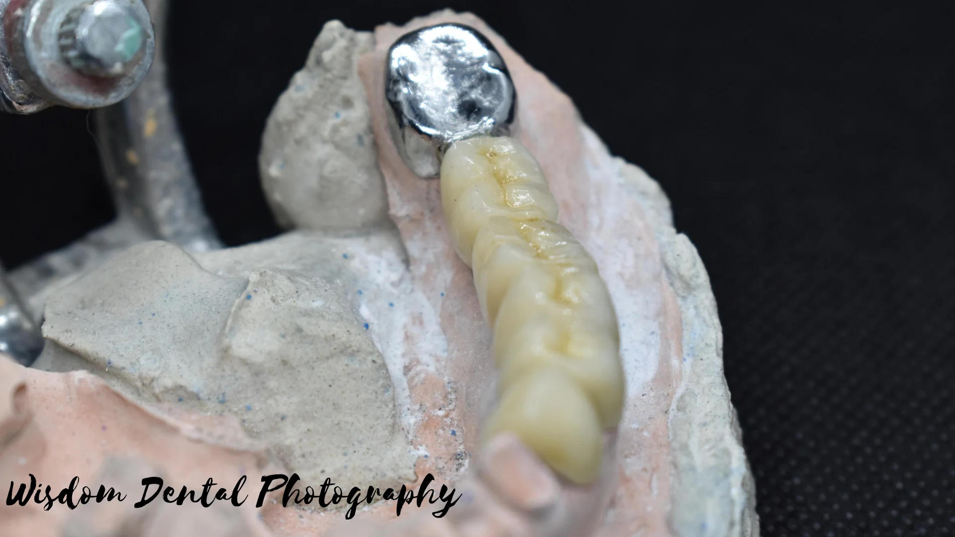 Wisdom Dental