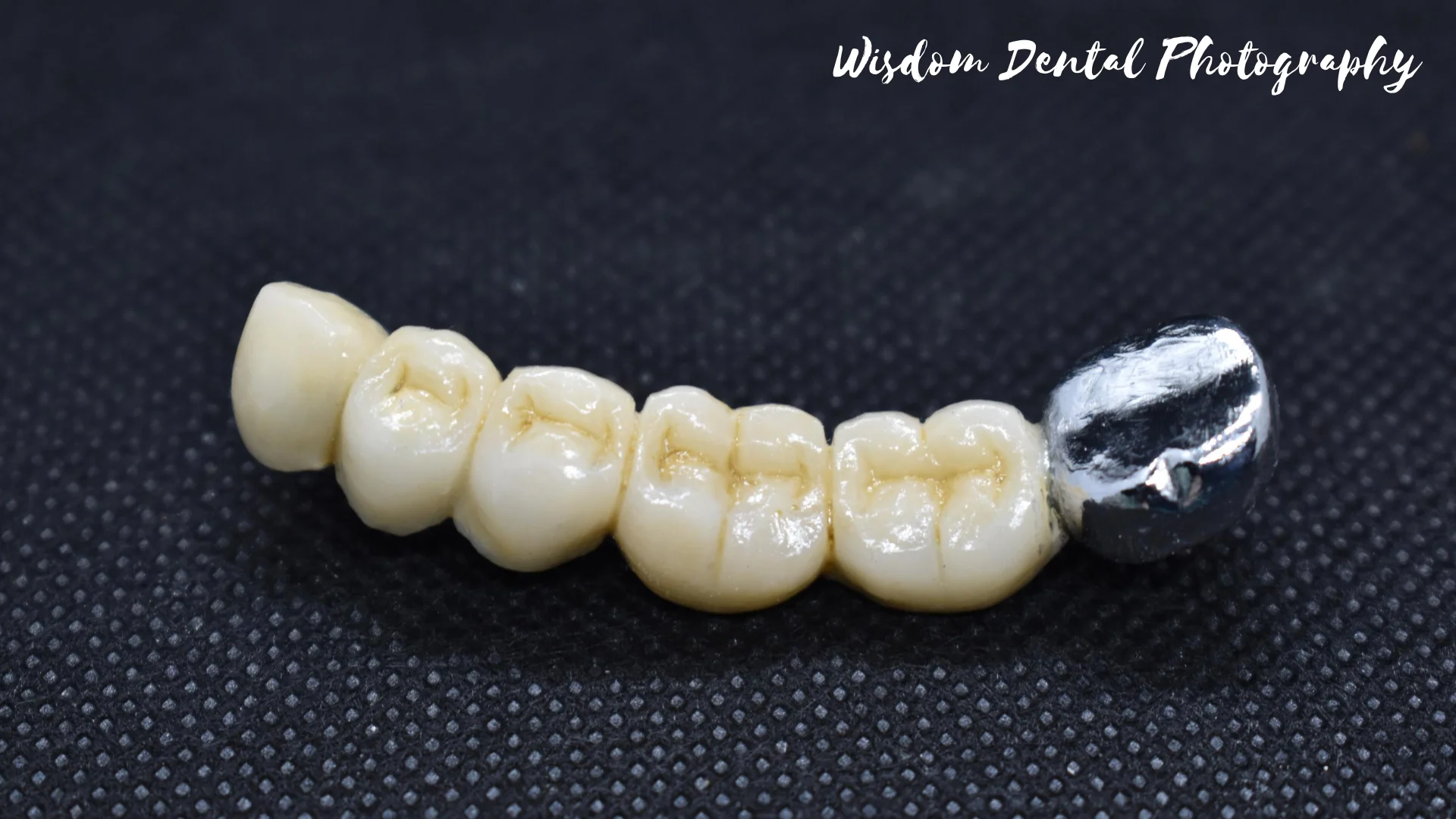 Wisdom Dental