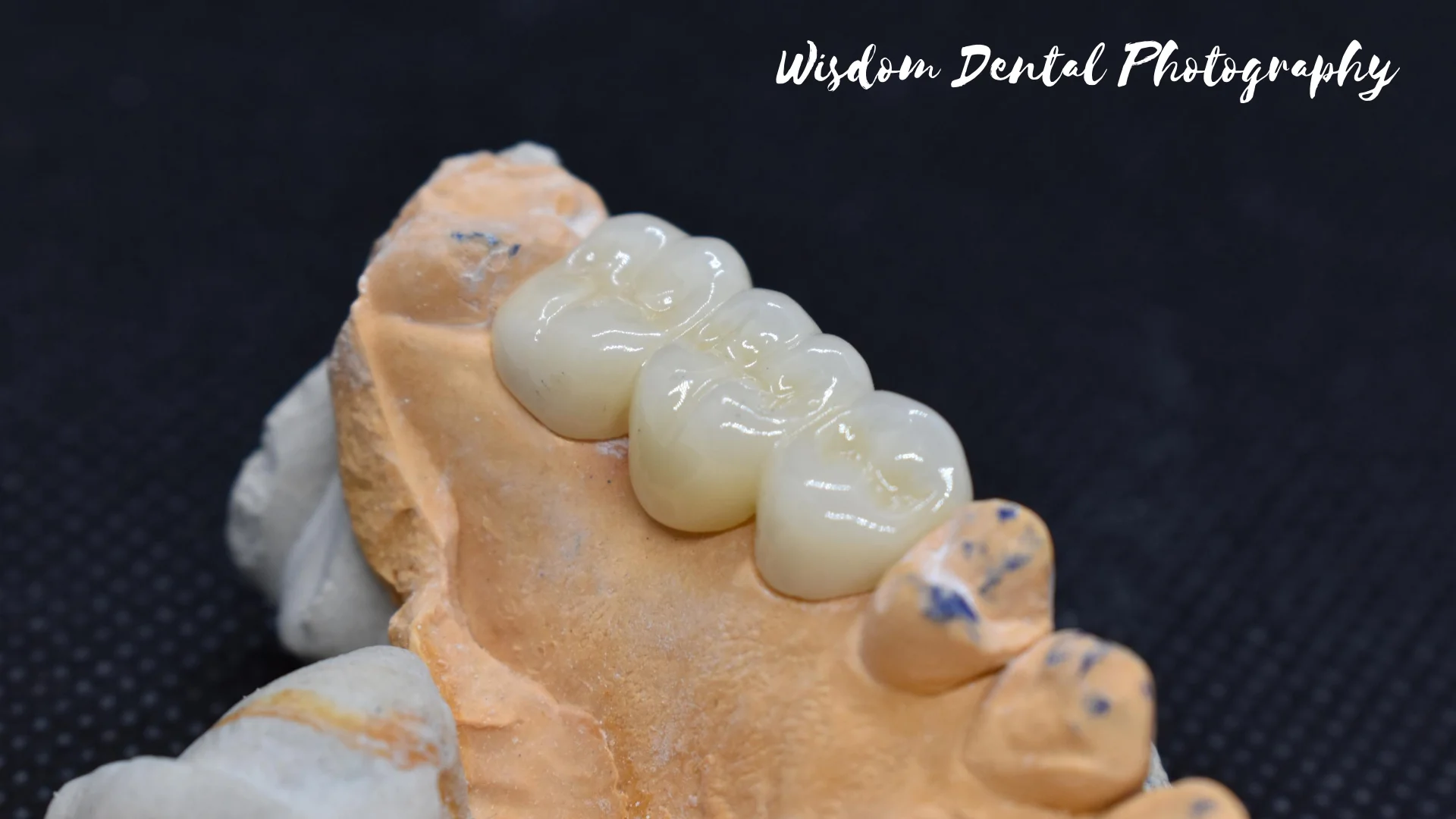 Wisdom Dental