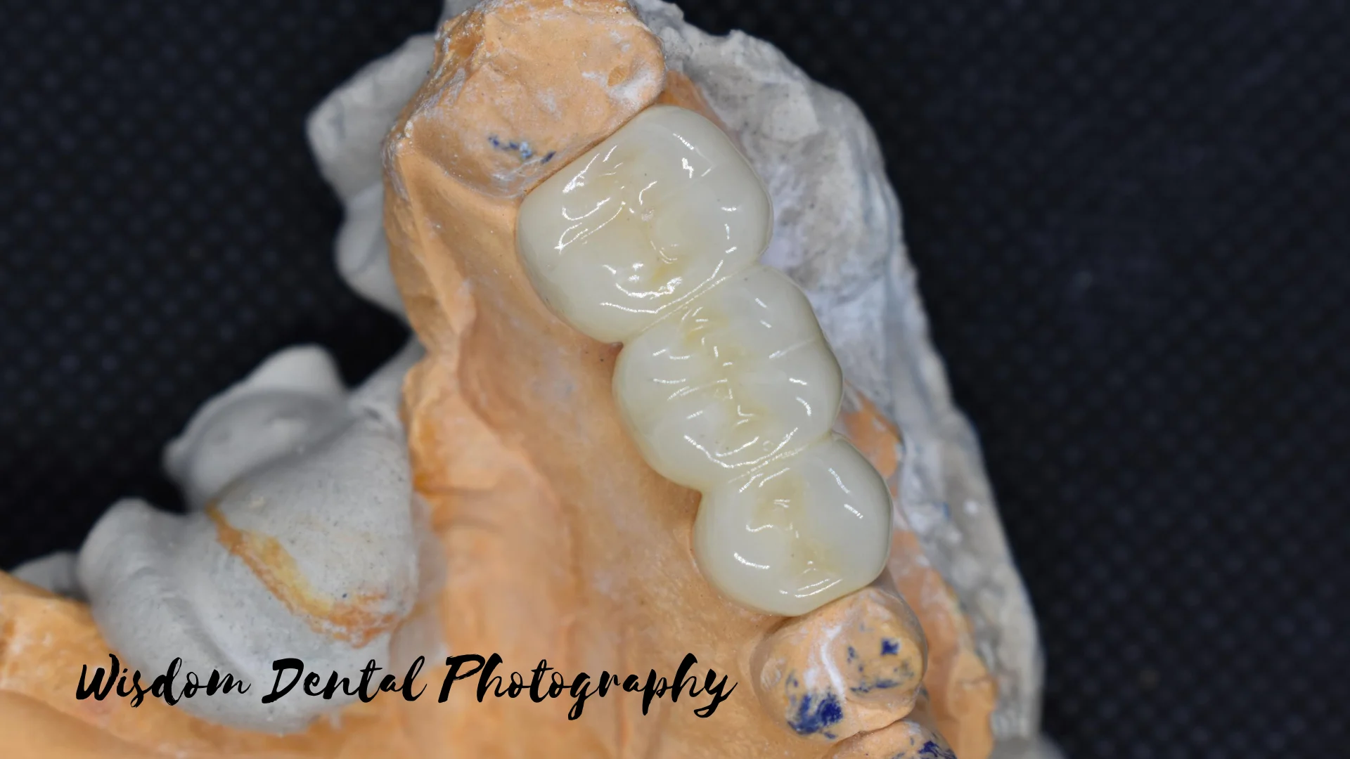 Wisdom Dental
