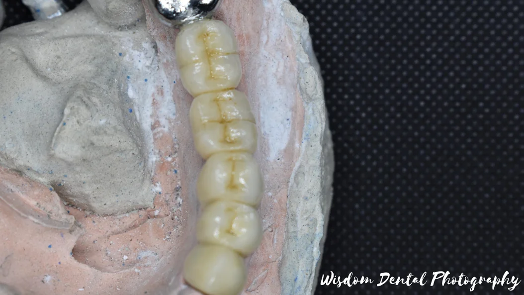 Wisdom Dental