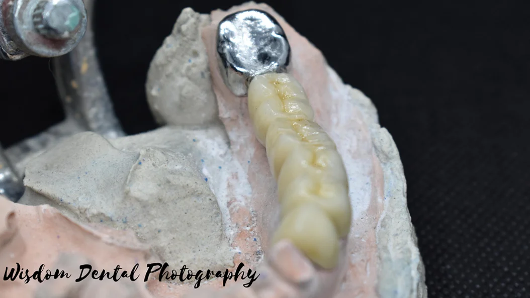 Wisdom Dental