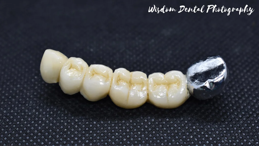 Wisdom Dental