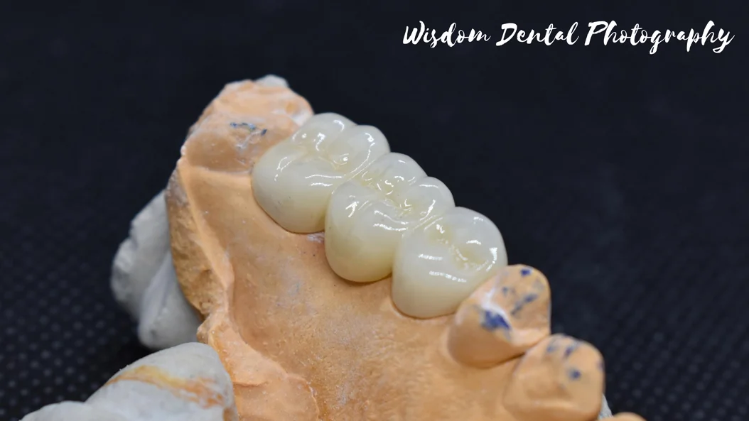 Wisdom Dental