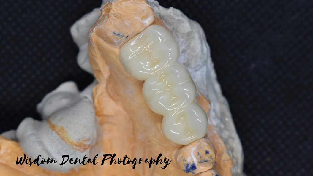 Wisdom Dental