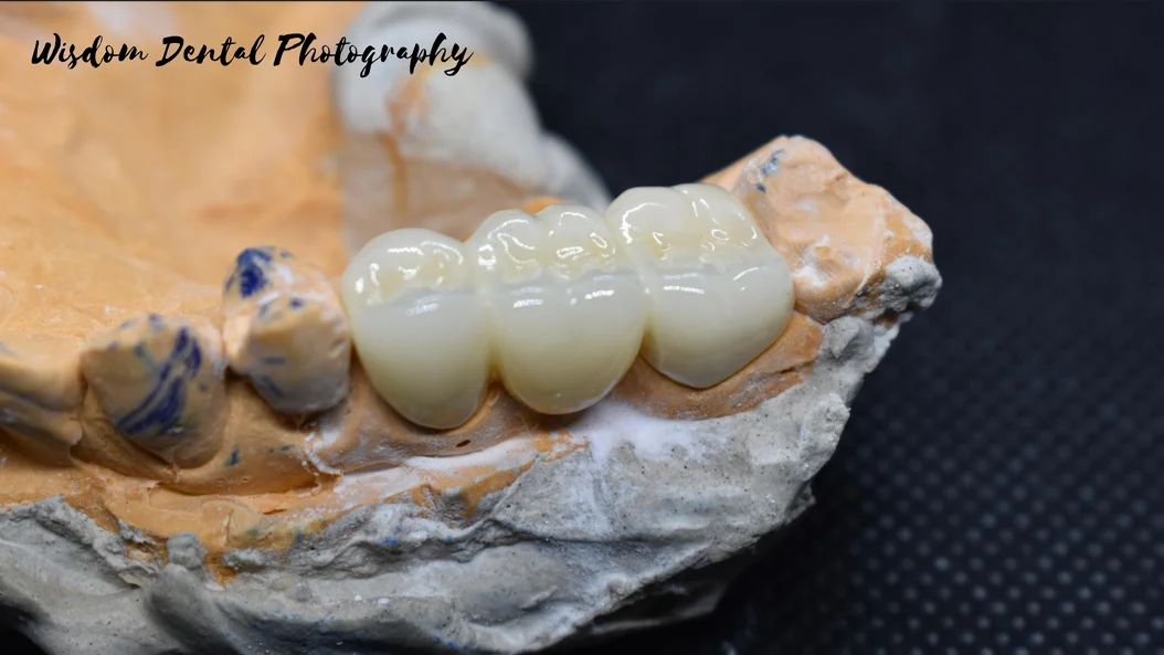 Wisdom Dental
