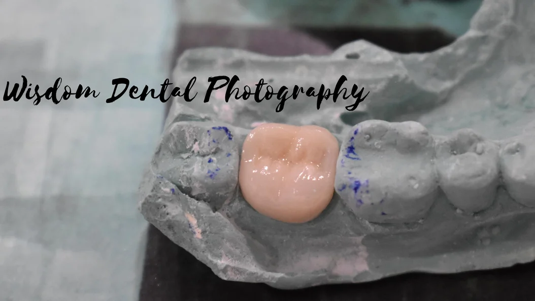 Wisdom Dental