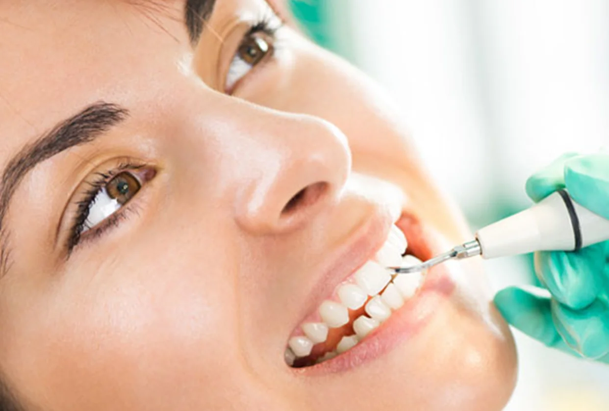 Teeth Cleaning and Polishing