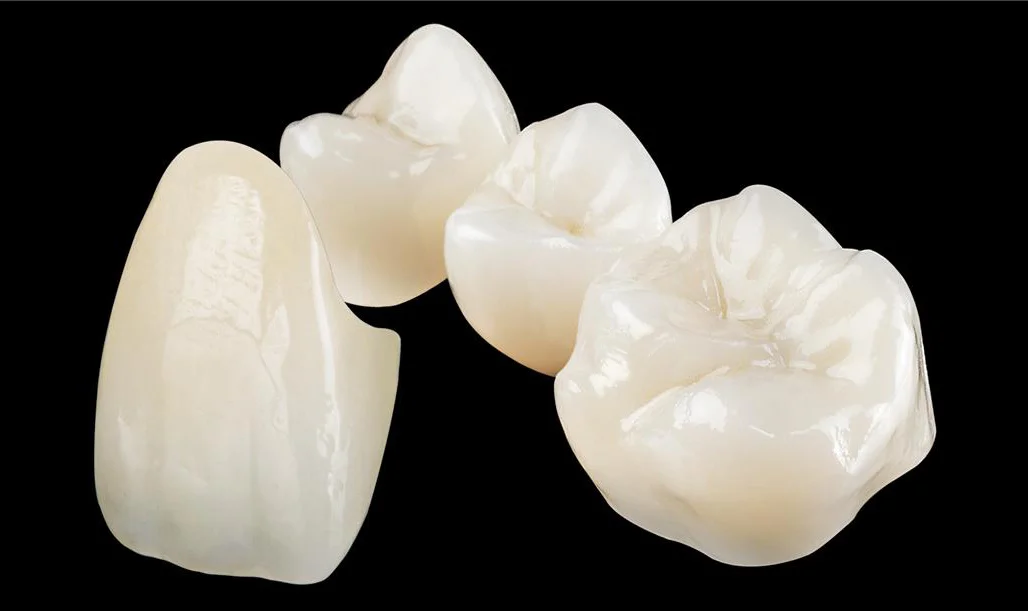 Ceramic Crowns and Bridges