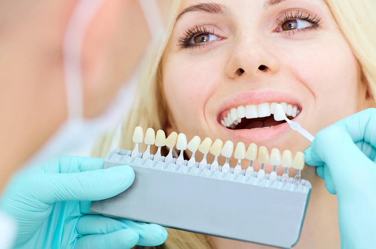 Composite Fillings/ Restorative Dentistry